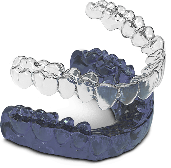 invisalign model