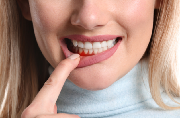 Woman with gum inflammation closeup