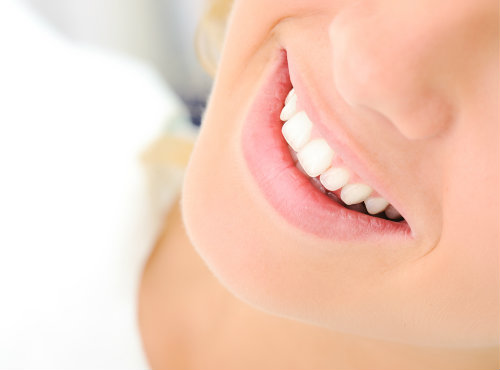 Dental Veneers in Sherwood, OR