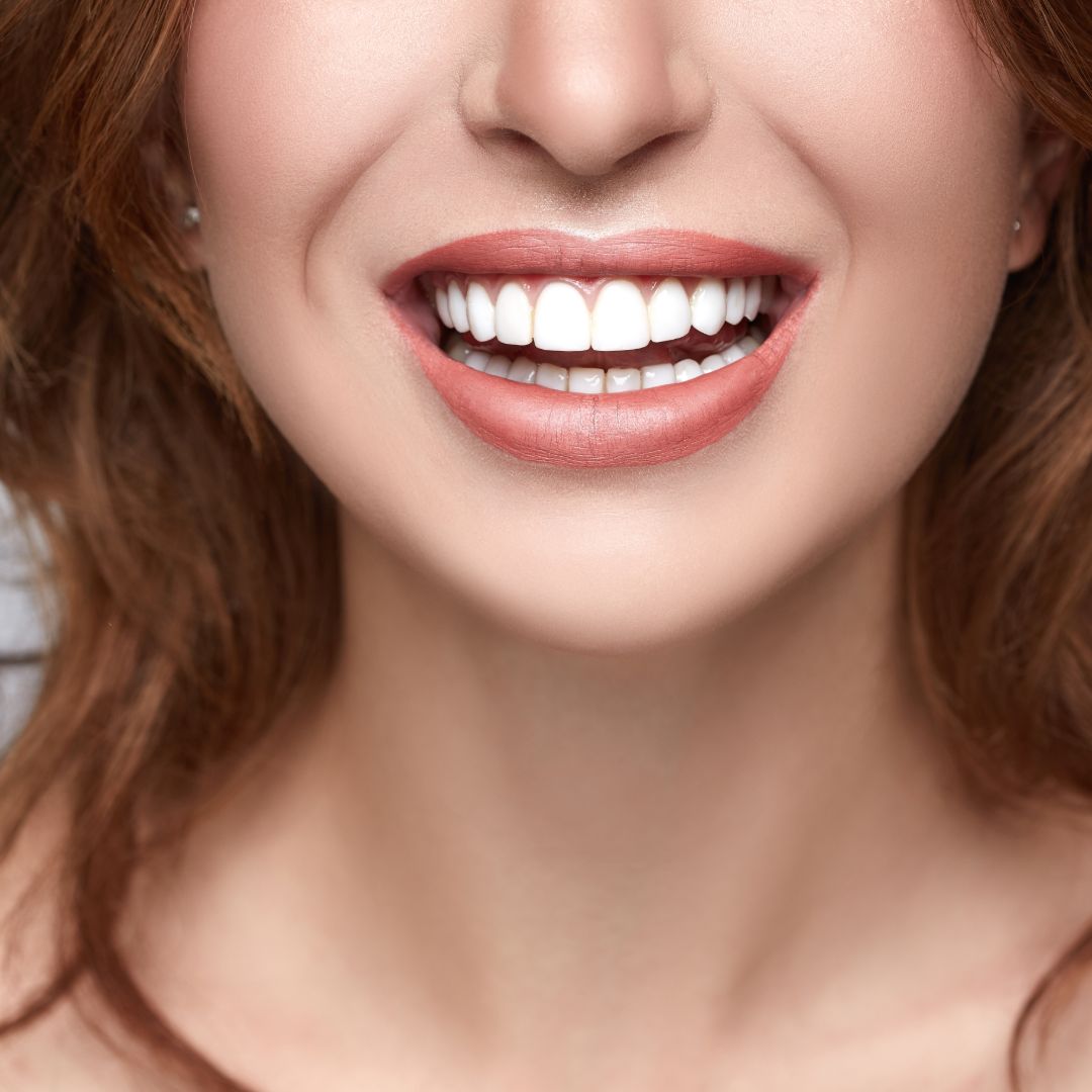 Teeth Whitening Patient