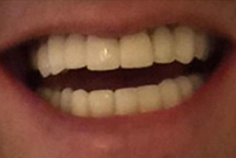 After