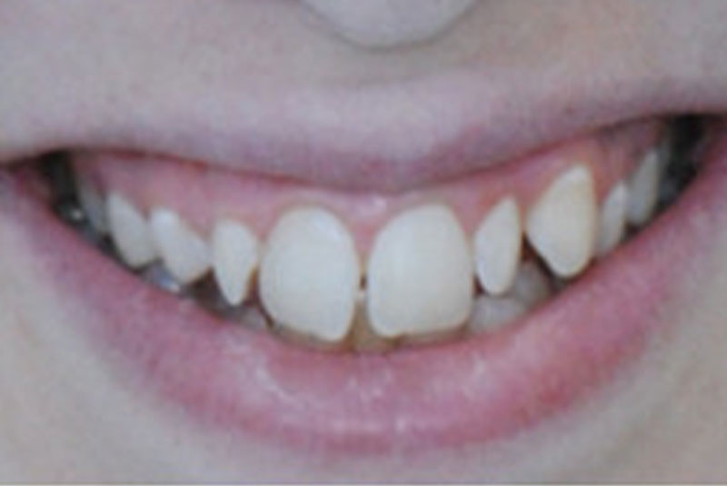 Before