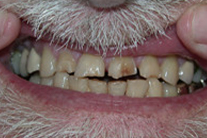Before